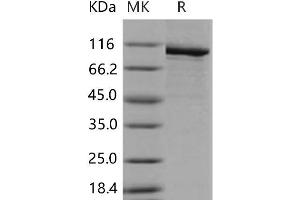Western Blotting (WB) image for Poly (ADP-Ribose) Polymerase 1 (PARP1) (Active) protein (His tag) (ABIN7320158) (PARP1 Protein (His tag))