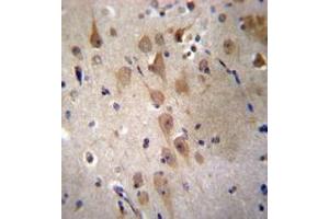 Immunohistochemistry analysis in formalin fixed and paraffin embedded human brain tissue reacted with GRIP2 Antibody (Center) followed by peroxidase conjugation of the secondary antibody and DAB staining.