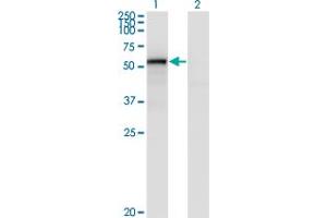 Western Blot analysis of ENG expression in transfected 293T cell line by ENG monoclonal antibody (M01), clone 4C11. (Endoglin antibody  (AA 27-658))