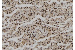 ABIN6273210 at 1/100 staining Human lung tissue by IHC-P. (CNOT10 antibody  (Internal Region))