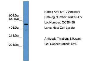 WB Suggested Anti-SYT2  Antibody Titration: 0. (SYT2 antibody  (C-Term))