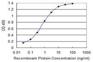 Detection limit for recombinant GST tagged RAB1B is 0. (RAB1B antibody  (AA 91-201))
