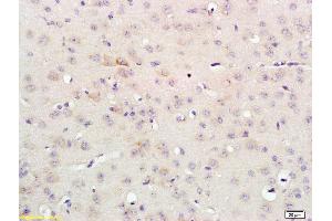 Formalin-fixed and paraffin embedded rat brain labeled with Anti-FGFR3/CD333 Polyclonal Antibody, Unconjugated (ABIN674664) at 1:200 followed by conjugation to the secondary antibody and DAB staining (FGFR3 antibody  (AA 501-600))