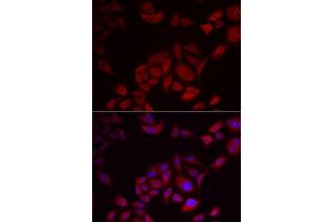 Immunofluorescence analysis of U2OS cells using PIKFYVE antibody.