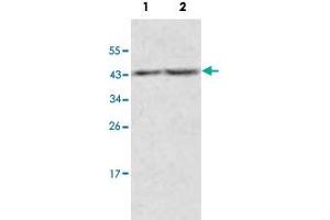 Western blot analysis of human fetal kidney (Lane 1) and fetal thymus (Lane 2) lysate with ACOT9 polyclonal antibody  at 1 : 500 dilution. (ACOT9 antibody  (AA 3-212))