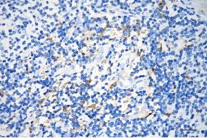 anti-alpha-Glucosidase (AGLU) antibody