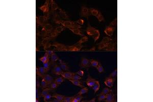 Immunofluorescence analysis of C6 cells using Neuropilin-1 (Neuropilin-1 (NRP1)) antibody (ABIN7268892) at dilution of 1:100. (Neuropilin 1 antibody  (AA 21-250))