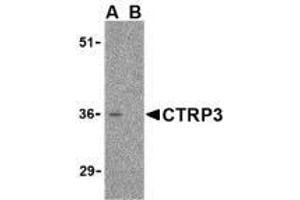 Western blot analysis of CTRP3 in mouse heart cell lysate with AP30251PU-N CTRP3 antibody at 1 μg/ml in the (A) absence and (B) presence of blocking peptide. (C1QTNF3 antibody  (Intermediate Domain))
