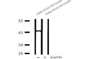 Western blot analysis of extracts from Hela whole cell lysate at 30ug, using CAPG Antibody.