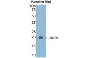 Western Blotting (WB) image for anti-Haptoglobin (HP) (AA 118-281) antibody (ABIN1078101) (Haptoglobin antibody  (AA 118-281))