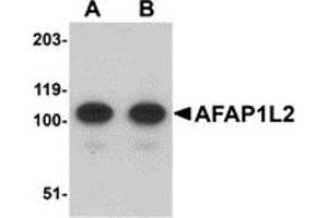 Western Blotting (WB) image for anti-Actin Filament Associated Protein 1-Like 2 (AFAP1L2) (C-Term) antibody (ABIN1030225) (AFAP1L2 antibody  (C-Term))