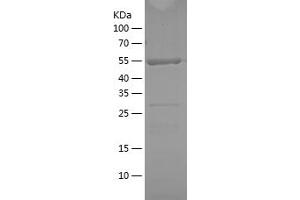 Western Blotting (WB) image for TNF Receptor-Associated Factor 2 (TRAF2) (AA 306-501) protein (His-IF2DI Tag) (ABIN7125407) (TRAF2 Protein (AA 306-501) (His-IF2DI Tag))