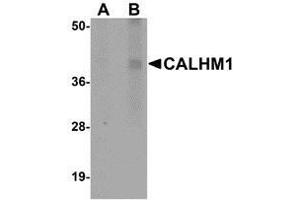 Western blot analysis of CALHM1 in rat liver tissue lysate with AP30176PU-N CALHM1 antibody at (A) 1 and (B) 2 μg/ml. (CALHM1 antibody  (N-Term))