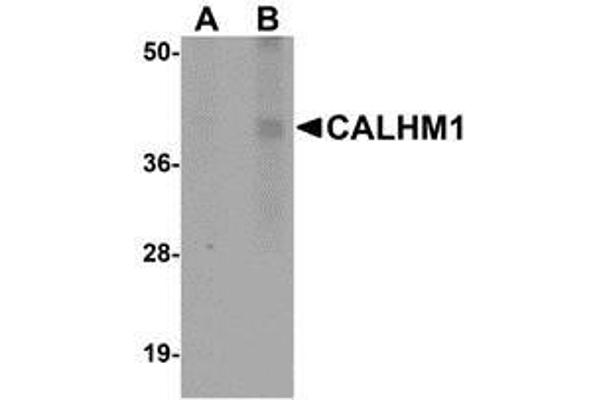 CALHM1 antibody  (N-Term)