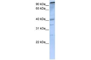 WB Suggested Anti-PCAF Antibody Titration: 0. (KAT2B antibody  (C-Term))