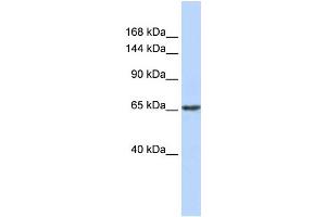 WB Suggested Anti-ZNF91 Antibody Titration:  0. (ZFP91 antibody  (N-Term))