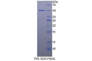 SDS-PAGE (SDS) image for Nephrosis 1, Congenital, Finnish Type (Nephrin) (NPHS1) protein (ABIN3010868)