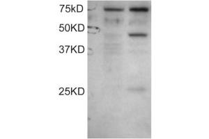 Western Blotting (WB) image for anti-Dyslexia Susceptibility 1 Candidate 1 (DYX1C1) (C-Term) antibody (ABIN2465629)