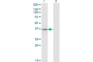 Western Blot analysis of RFXAP expression in transfected 293T cell line by RFXAP monoclonal antibody (M01), clone 1B5. (RFXAP antibody  (AA 179-244))