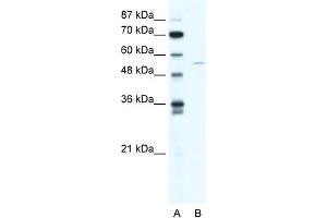 Human HepG2; WB Suggested Anti-ZNF289 Antibody Titration: 1.