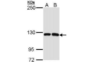 WB Image Sample (30 ug of whole cell lysate) A: Molt-4 , B: Raji 5% SDS PAGE antibody diluted at 1:1000