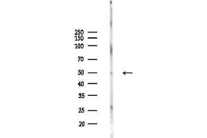 anti-Solute Carrier Family 11 (Proton-Coupled Divalent Metal Ion Transporters), Member 2 (SLC11A2) (N-Term) antibody