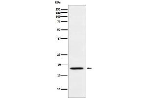 Western blot analysis of MTH1 expression in Jurkat cell lysate. (Recombinant NUDT1 antibody)