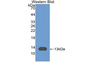 Detection of Recombinant ITaC, Mouse using Polyclonal Antibody to Interferon Inducible T-Cell Alpha Chemoattractant (ITaC) (CXCL11 antibody  (AA 22-100))