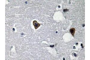 Immunohistochemistry analyzes of Sarcoglycan-β antibody in paraffin-embedded human brain tissue. (SGCB antibody)