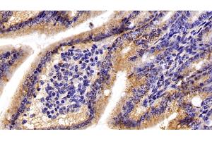 Detection of C1QBP in Mouse Small intestine Tissue using Polyclonal Antibody to Complement component 1 Q subcomponent-binding protein, mitochondrial (C1QBP) (C1QBP antibody  (AA 71-278))