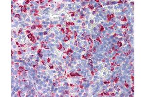 Anti-CD68 antibody IHC of rat spleen. (CD68 antibody)