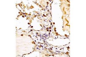 CLIC6 antibody