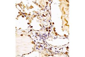 Immunohistochemistry analysis of paraffin-embedded human lung using,CLIC6 (ABIN7073478) at dilution of 1: 600