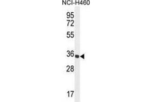Western blot analysis in NCI-H460 cell line lysates (35ug/lane) using Trypsin-1 / PRSS1  Antibody . (PRSS1 antibody  (Middle Region))