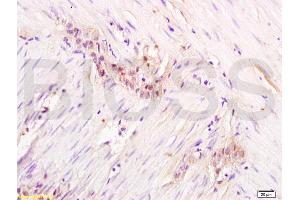 Formalin-fixed and paraffin embedded rat colon labeled with Anti-Gemin 2 Polyclonal Antibody, Unconjugated  at 1:200 followed by conjugation to the secondary antibody and DAB staining.