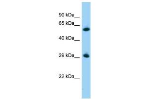 WB Suggested Anti-Zbtb7a Antibody   Titration: 1. (ZBTB7A antibody  (C-Term))