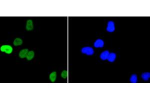 HeLa cells were stained with c-Myc(S62) (1A7 ) Monoclonal Antibody (b at [1:200] incubated overnight at 4C, followed by secondary antibody incubation, DAPI staining of the nuclei and detection. (c-MYC antibody  (pSer62))