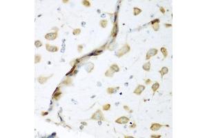 Immunohistochemistry of paraffin-embedded mouse brain using EL antibody (ABIN6134649, ABIN6140114, ABIN6140116 and ABIN6221621) at dilution of 1:200 (40x lens). (ELAVL2 antibody  (AA 1-100))