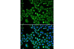 Immunofluorescence analysis of A549 cell using ECI1 antibody. (DCI antibody  (AA 63-302))