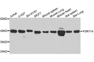 Western blot analysis of extracts of various cell lines, using P2RY14 antibody. (P2RY14 antibody  (AA 209-338))