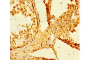 Immunohistochemistry (IHC) image for anti-SMAD, Mothers Against DPP Homolog 5 (SMAD5) (AA 1-209) antibody (ABIN7160242)