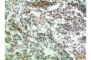 Immunohistochemical analysis of paraffin-embedded Human-spleen, antibody was diluted at 1:100 (CD247 antibody  (AA 51-100))