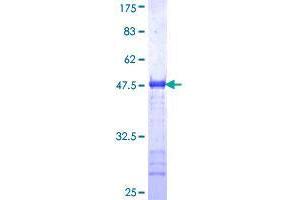 GOLM1 Protein (AA 302-401) (GST tag)