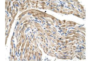 FADS1 antibody was used for immunohistochemistry at a concentration of 4-8 ug/ml to stain Skeletal muscle cells (arrows) in Human Muscle. (FADS1 antibody  (C-Term))