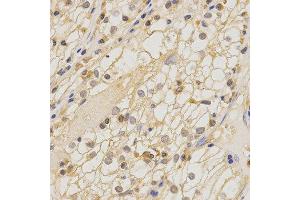 Immunohistochemistry (IHC) image for anti-Claudin 11 (CLDN11) antibody (ABIN1871890) (Claudin 11 antibody)