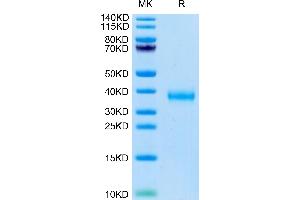 SARS-COV-2 Spike RBD (Delta B. (SARS-CoV-2 Spike Protein (B.1.617.2 - delta, RBD) (His tag))