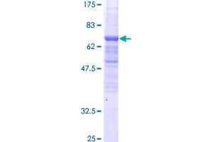 BAF53A Protein (AA 1-387) (GST tag)