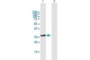 Western Blot analysis of RAB32 expression in transfected 293T cell line by RAB32 MaxPab polyclonal antibody. (RAB32 antibody  (AA 1-225))