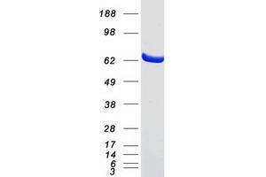 Validation with Western Blot (CROT Protein (Transcript Variant 2) (Myc-DYKDDDDK Tag))