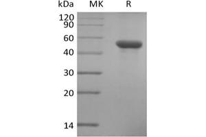 Western Blotting (WB) image for Immunoglobulin-Like Domain Containing Receptor 2 (ILDR2) protein (His tag) (ABIN7319930) (ILDR2 Protein (His tag))